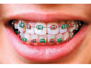 PRO DENT Dental clinics Prokuplje - Photo 1