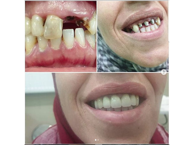 DENTAL SURGERY SKANDRANIN Dental clinics Novi Pazar - Photo 8